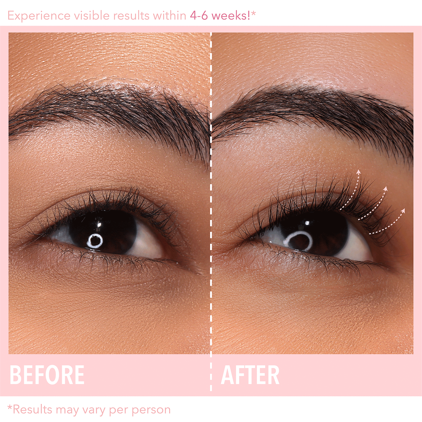 Biotin-Peptide Complex Vippe-Serum